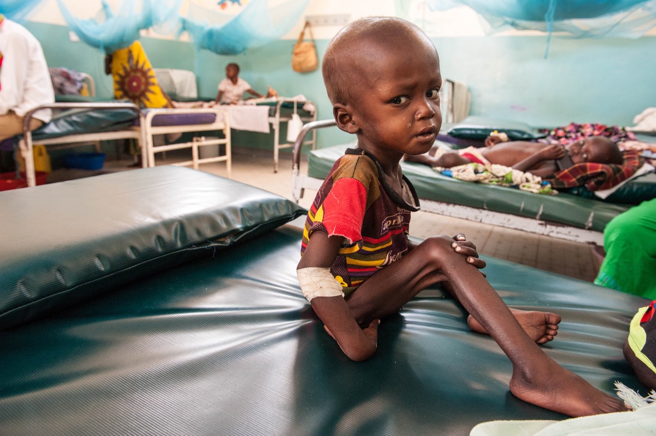 Naroi is barely able to swallow a cap-full of water because of the severe acute malnutrition and thrush that he is facing. 