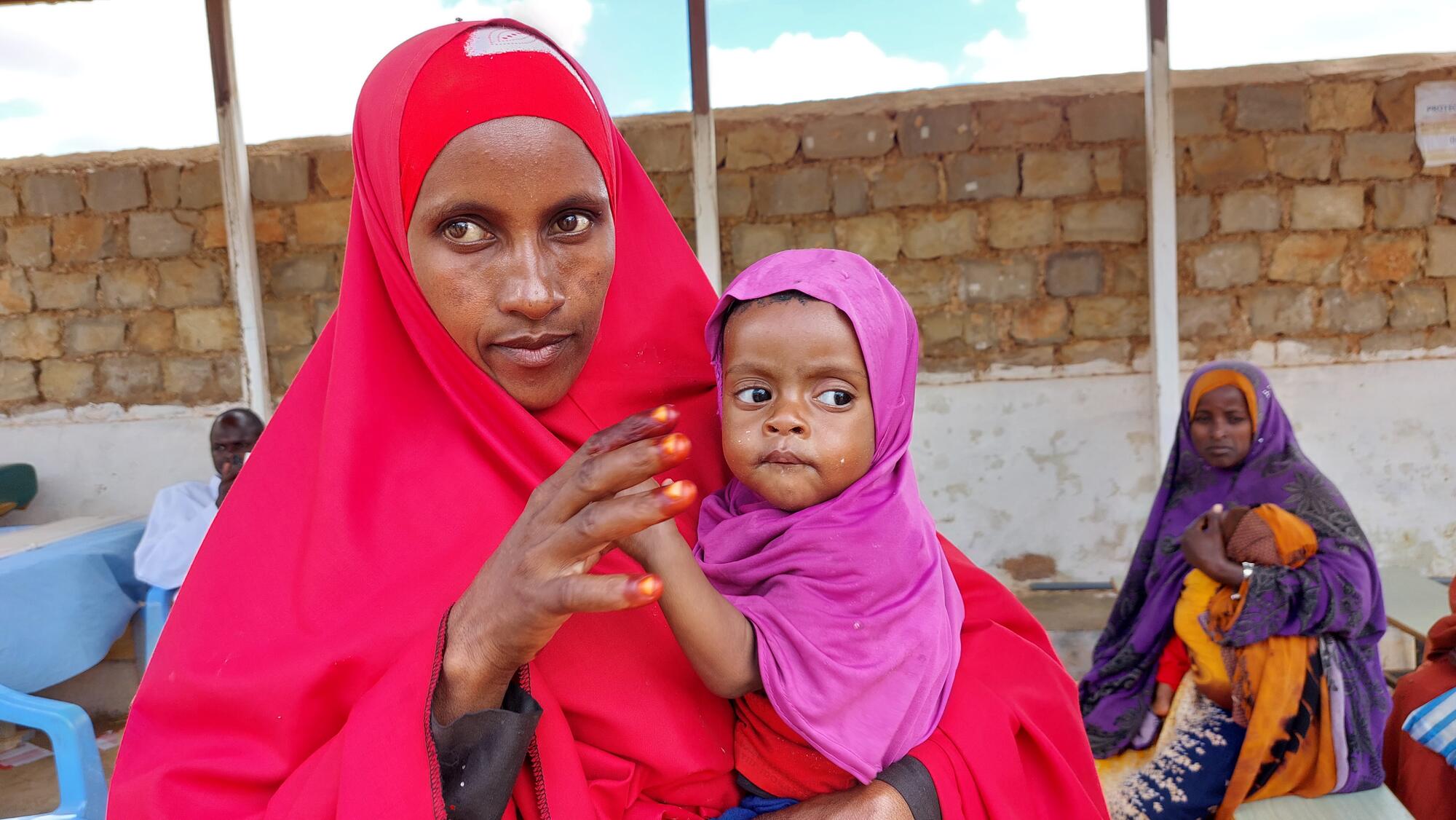 From Severe Acute Malnutrition to a steady recovery: Hamdi’s journey ...