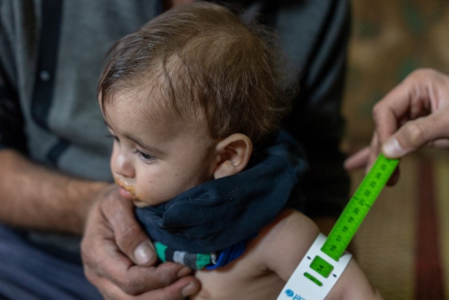 The malnutrition measurement (MUAC) for Abu Ali's youngest child.                                                                World Vision Syria Response - Zaher Jaber