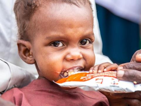 Malnourished child eats ready to eat therapeutic food