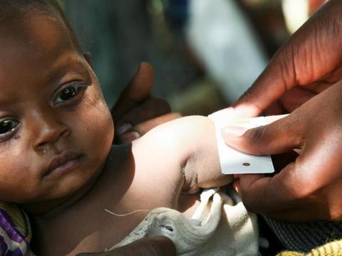 Community Managed Acute Malnutrition Management