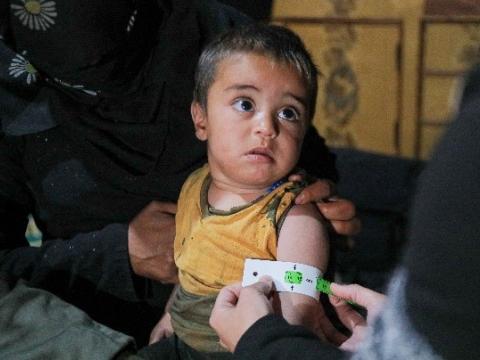 Zaid after receiving the medical care for severe malnutrition. 