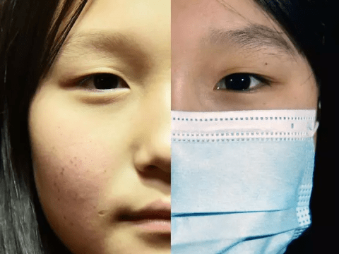 child's face half covered by a medical mask